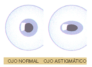 Ojos astigmaticos